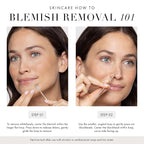 Tweezerman Rose Gold No Slip Skin Care Tool - Image 4