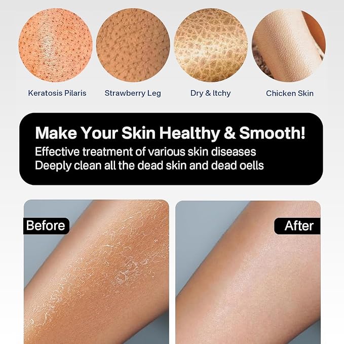 Yiclick Heavy Exfoliating Gloves, Exfoliating Body Scrubber - Image 6