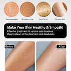 Yiclick Heavy Exfoliating Gloves, Exfoliating Body Scrubber - Image 6