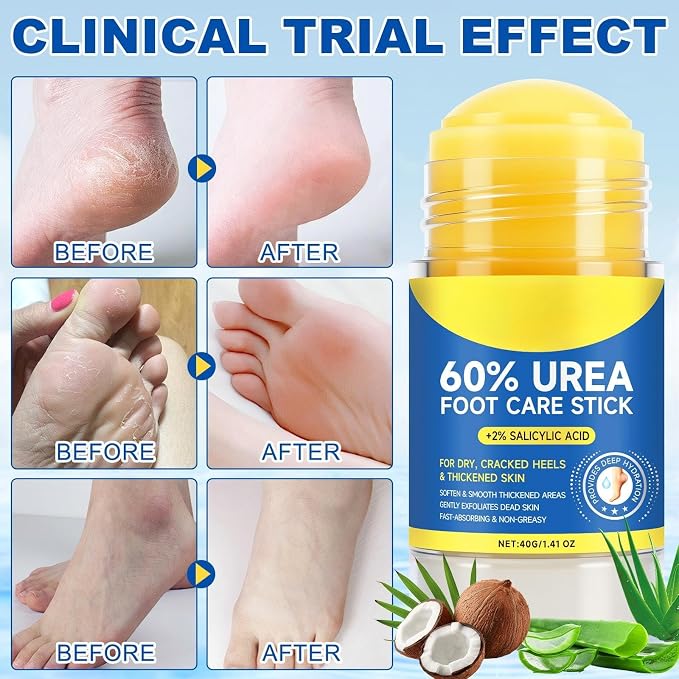 2 Pack Urea Cream 60% plus Salicylic Acid 2%, Maximum Strength Urea Foot Cream - Image 3