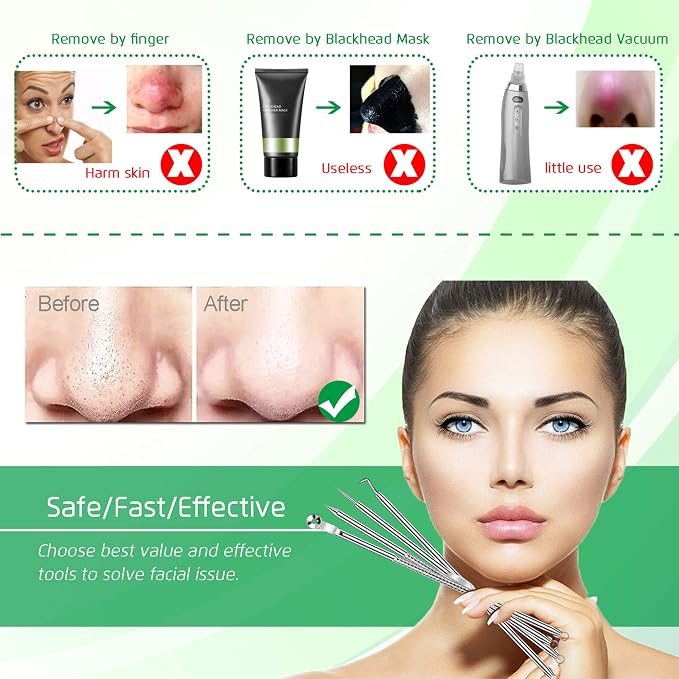 5PCS Blackhead Remover Comedone Extractor, Curved Blackhead Tweezers Kit - Image 2
