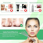 5PCS Blackhead Remover Comedone Extractor, Curved Blackhead Tweezers Kit - Image 2