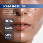TURMSKIN® Hyaluronic Acid Serum Ampoules - Image 6