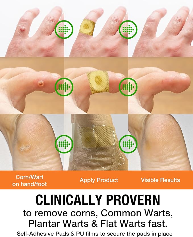 Samsali Wart Corn Remover Pads for Feet: 42 Pack Salicylic Acid Extra Strength - Image 3