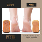 Facón Pumice Stone for Feet Callus Remover - Image 6