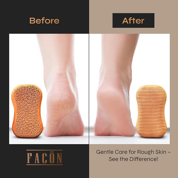 Facón Pumice Stone for Feet Callus Remover - Image 6