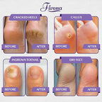 Fivona Foot Soak Blend Epsom Salt - Image 7