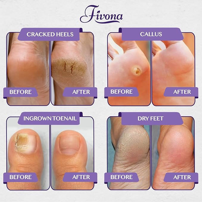 Fivona Foot Soak Blend Epsom Salt - Image 7