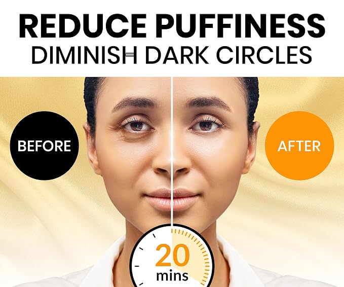 Stylia Under Eye Patches for Dark Circles and Puffy Eyes - Image 2