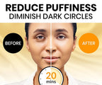 Stylia Under Eye Patches for Dark Circles and Puffy Eyes - Image 2