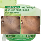 Matcha Toner Pads with Rose PDRN, Peptides & Hyaluronic Acid | Korean Facial - Image 2