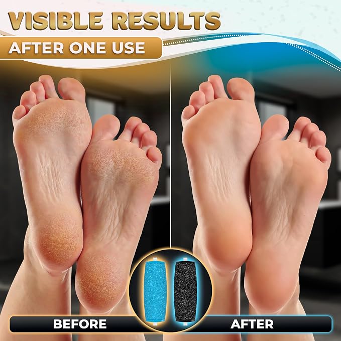 11 Pcs Replacement Rollers for Electric Foot Callus Remover Tool - Image 7