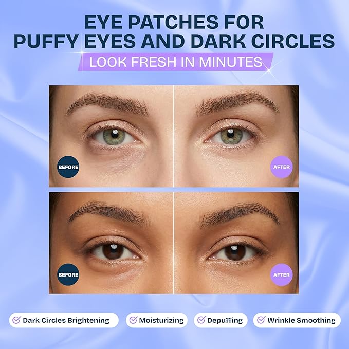 MAREE Under Eye Patches for Puffy Eyes and Dark Circles – Under Eye Mask - Image 2