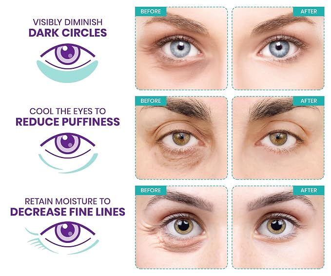 Stylia Under Eye Patches for Puffy Eyes and Dark Circles - Image 2