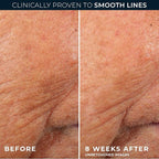 RoC Retinol Correxion Anti-Aging Wrinkle Night Serum, Retinol Serum - Image 5