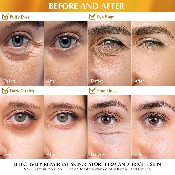 Enaskin Naturals Under Eye Patches - Image 3