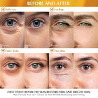 Enaskin Naturals Under Eye Patches - Image 3