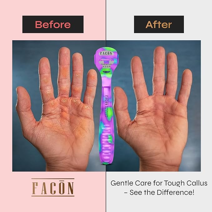 Facón Professional Callus Shaver Remover - Image 4