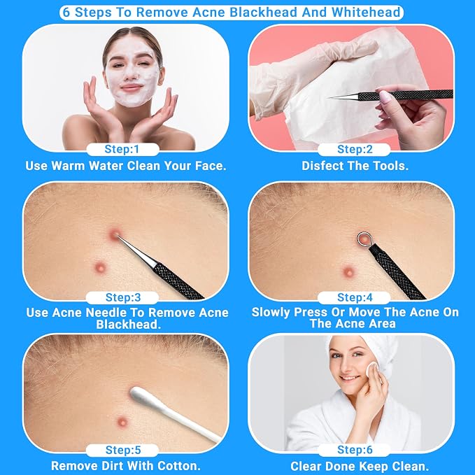 EFAH Care 2Pcs Stainless Steel Pimple Extractor Acne Treatment Tool Surgical - Image 5