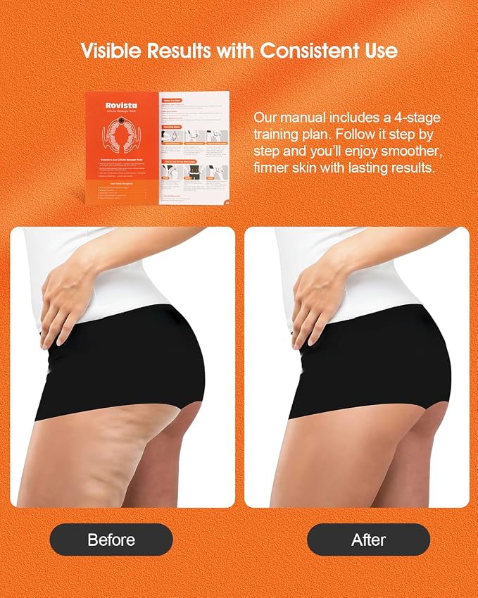 Anti Cellulite Massage Tool - Image 4