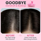 RELAXXO Scalp Massager Hair Growth – Exfoliator & Hair Scrubber - Image 3