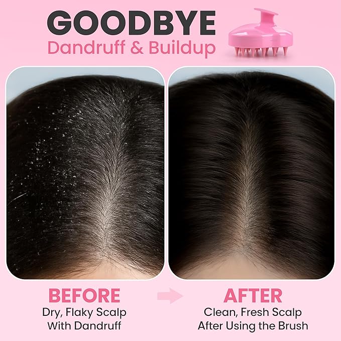 RELAXXO Scalp Massager Hair Growth – Exfoliator & Hair Scrubber - Image 3