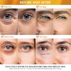 Enaskin Naturals Under Eye Patches Dark Circles Under Eye Masks - Image 3
