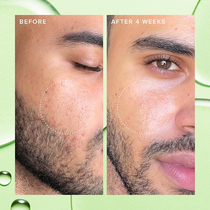 Farmacy 2% Salicylic Acid Toner - Image 4