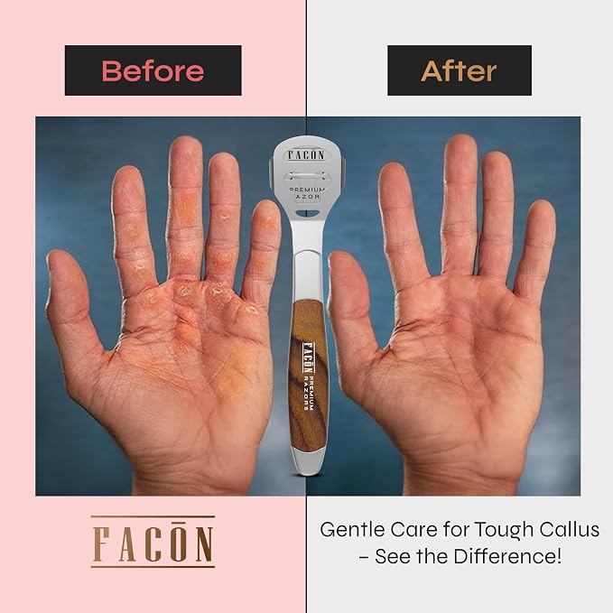 Facón Professional Callus Shaver Remover - Image 4