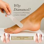 Diamancel Luxury Diamond Foot Callus File Rasp & Buffer – Canadian Professional - Image 4