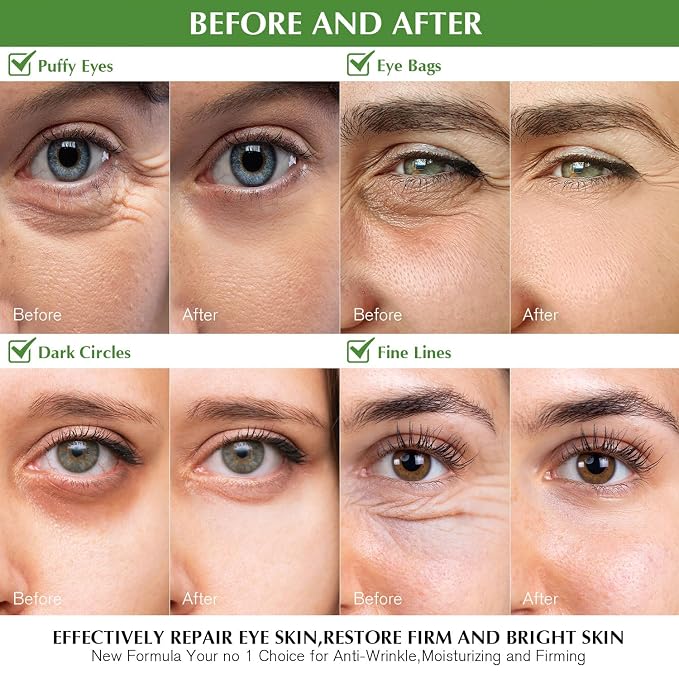Under Eye Patches for Dark Circles: 30 Pairs Green Tea Eye Gels Pads - Image 2