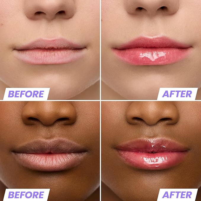 Wonderskin Lip Oil Rehab Serum - Image 3