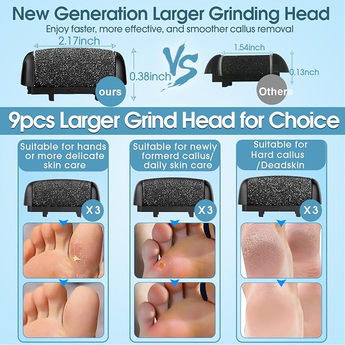 Electric Foot File Callus Remover - Image 3