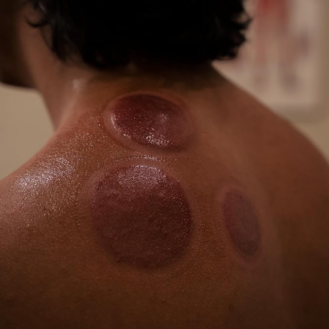 Myofascial Releaser Professional Cupping Therapy Set - Image 8