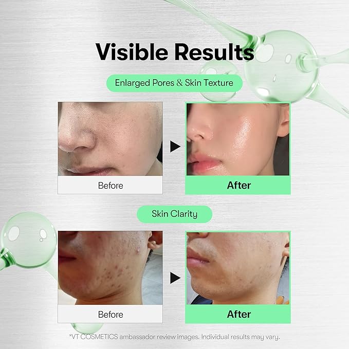 VT COSMETICS CICA Reedle Shot 700, Spicule Microneedling Serum - Image 3