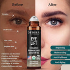 Organic Castor Oil and Frankincense Roll On – 100% Pure Hexane Free Eye Oil - Image 7