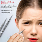 Suvorna Pimple Popper Tool Kit | Milia Remover | Lancets - Image 5