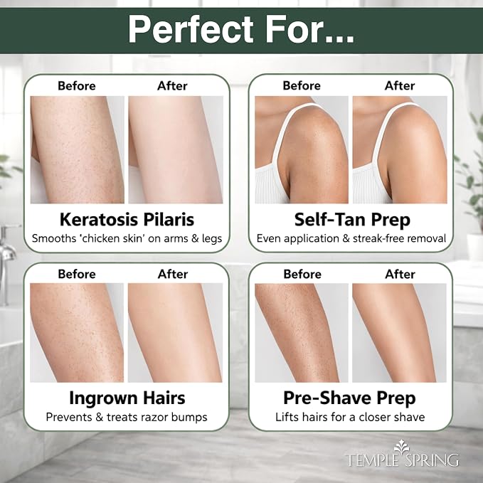 Temple Spring Shower Gloves Exfoliating - Image 6