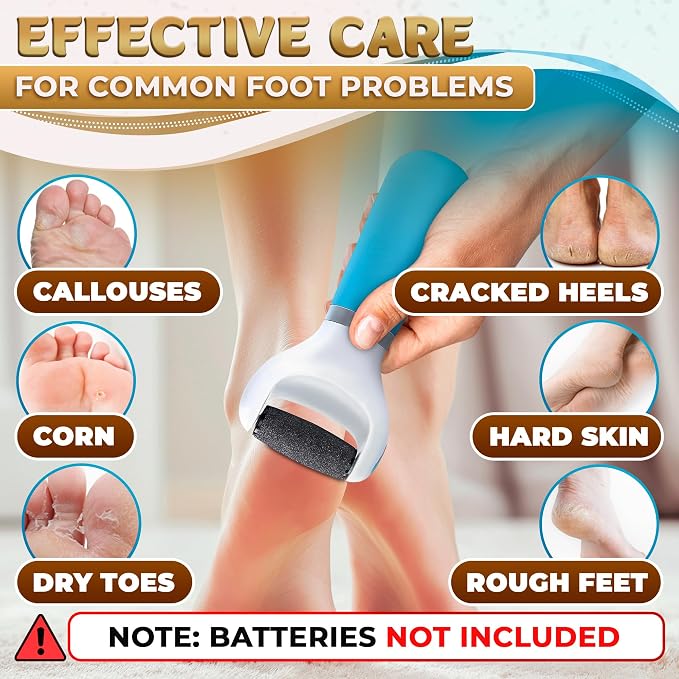 Electric Foot Callus Remover Tool | Batteries Not Included – High-Speed Foot - Image 8