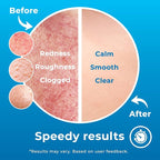 PatchRx Hypochlorous Acid Spray, HOCL Facial Cleanser Acne Spray - Image 6