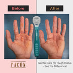 Facón Professional Callus Shaver Remover - Image 4