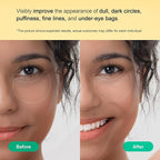 TEREZ & HONOR Vitamin C Eye Patches - Image 4