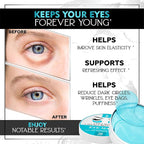 Under Eye Patches for Puffy Eyes, Dark Circles, Dull Skin - Image 2