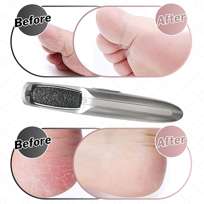 Powerful Electric Foot Callus Remover - Image 7
