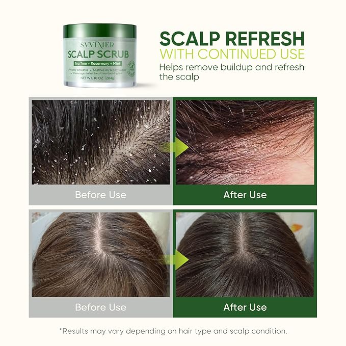Svvimer Scalp Care Essentials – Scalp Scrub and Scalp Massager Brush Options - Image 3