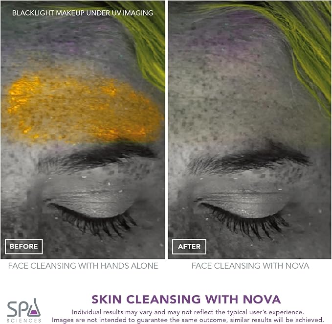 Spa Sciences - NOVA - Sonic Cleansing Brush - Image 7