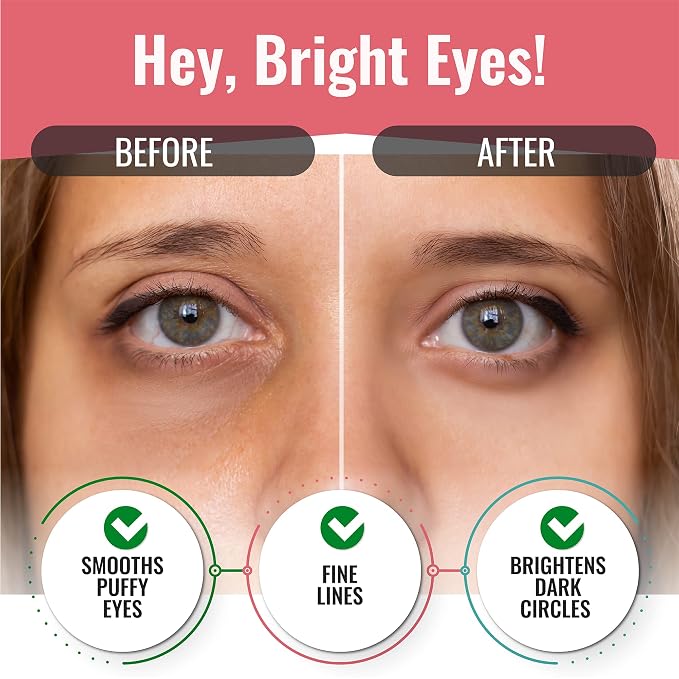 Under Eye Patches for Dark Circles and Puffiness - Image 2
