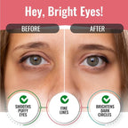Under Eye Patches for Dark Circles and Puffiness - Image 2