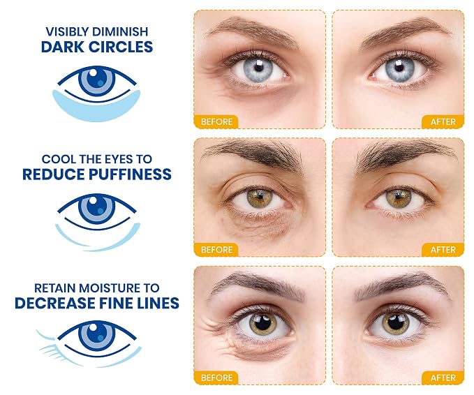 Stylia Under Eye Patches for Puffy Eyes and Dark Circles - Image 2