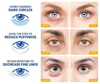 Stylia Under Eye Patches for Puffy Eyes and Dark Circles - Image 2
